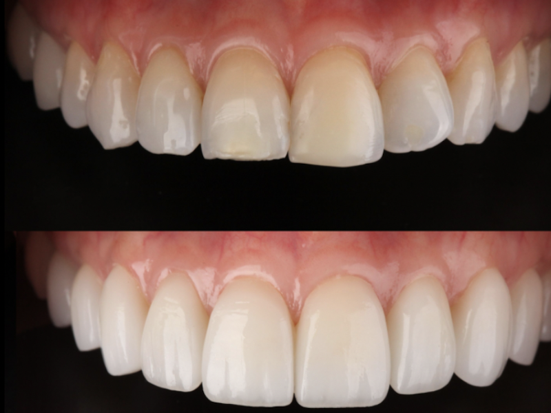 Foto 2 de Prince Dente Clínica Odontologica