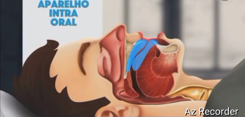 Foto 3 de Priscila Belli | Dentista | Aparelho Invisível SouSmile | Apneia do Sono | Bruxismo | Dor Orofacial | Itaquaquecetuba