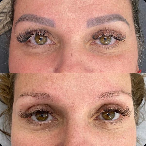 Foto 3 de Priscila Moreno Sobrancelhas Remoção a Laser & Caño Odontologia