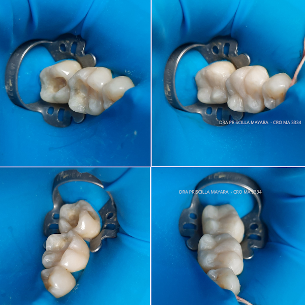 Foto 3 de Priscilla Mayara Reabilitação Oral