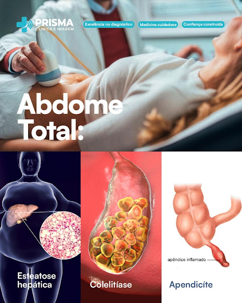 Foto 3 de PRISMA Clínica e Imagem | Ultrassom em Barreiras - BA