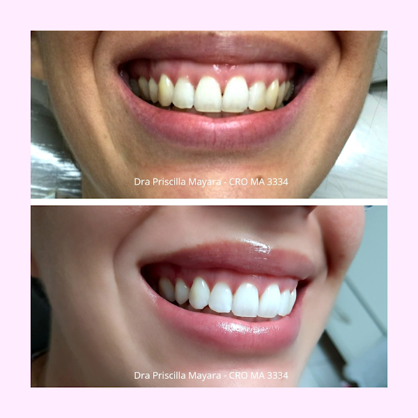 Foto 2 de PRISMA Odontologia