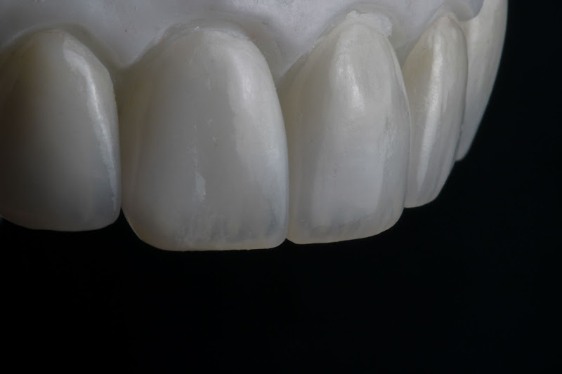 Foto 3 de Pro Dente - Laboratório de prótese - Prótese odontológica - Salvador