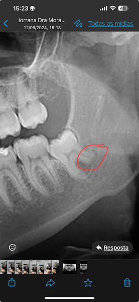 Foto 2 de Pró Dente Odontologia Paranoá