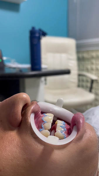 Foto 3 de Pró Dente Odontologia Paranoá