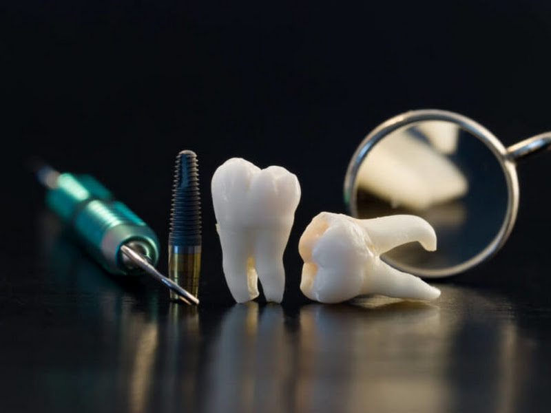 Foto 8 de PRO DENTES ODONTOLOGIA