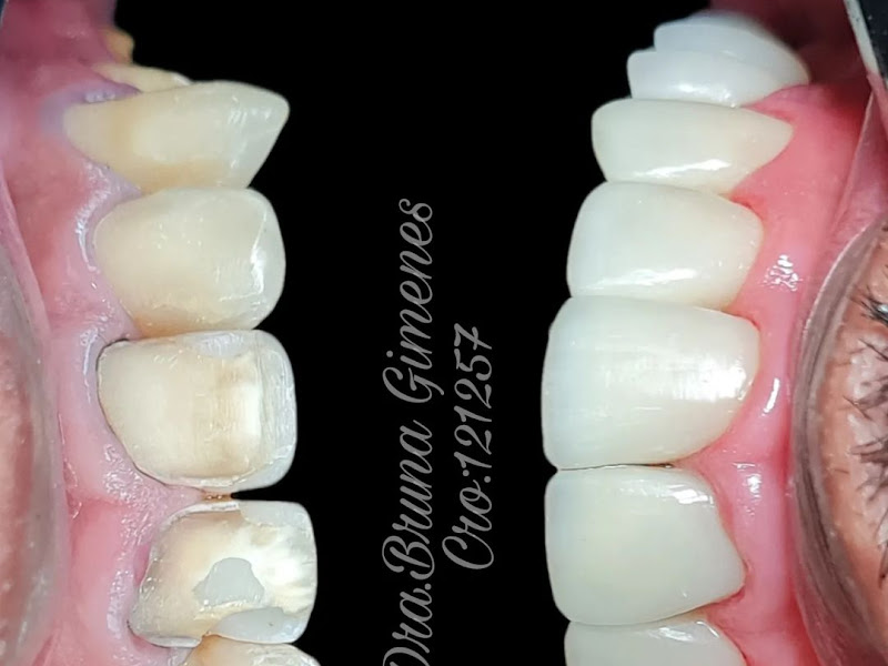 Foto 9 de Pró Previne Odontologia | Dentista no Brooklin em São Paulo