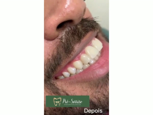 Foto 3 de Pró-Sorriso Odontologia