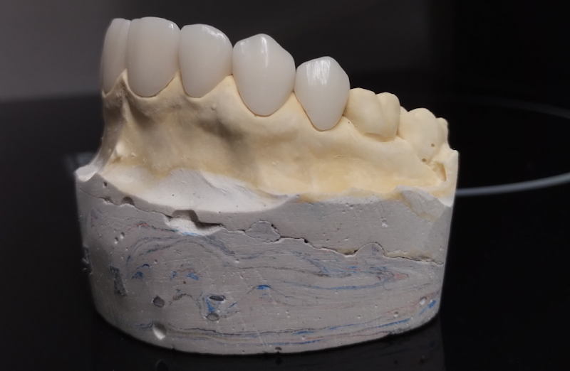 Foto 3 de Pró-Tec Odontologia e Próteses