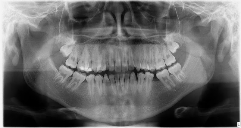 Foto 3 de Pro-X Radiologia Odontológica