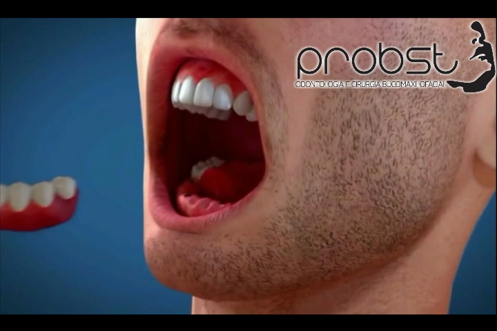Foto 3 de Probst Odontologia I Cirurgia Bucomaxilofacial em São Leopoldo