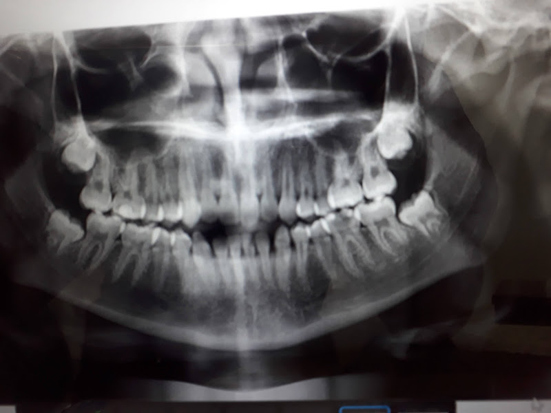 Foto 3 de PRODENT ODONTO Dr Elizomar Hatherly Galvao