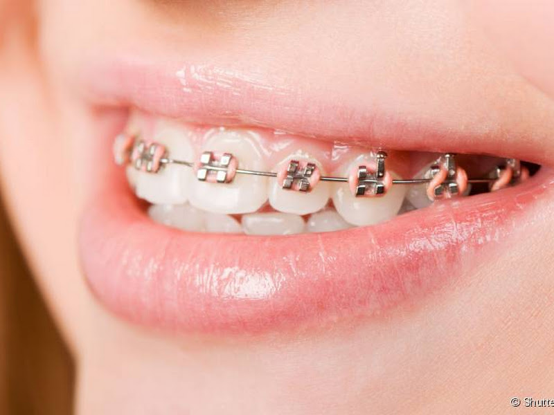 Foto 3 de PRODENTE ESPAÇO ODONTOLÓGICO