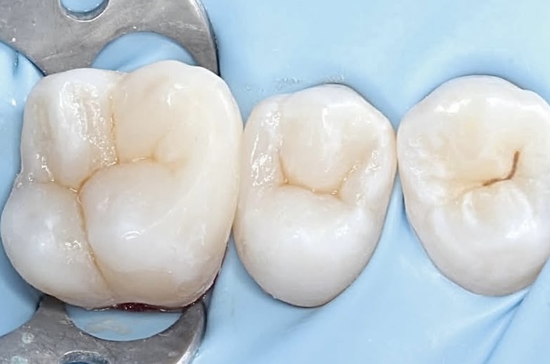 Foto 2 de Prodonto Juiz de Fora Odontologia Especializada.