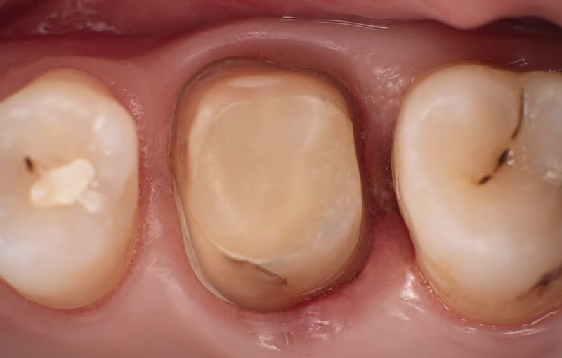 Foto 3 de Prodonto Juiz de Fora Odontologia Especializada.