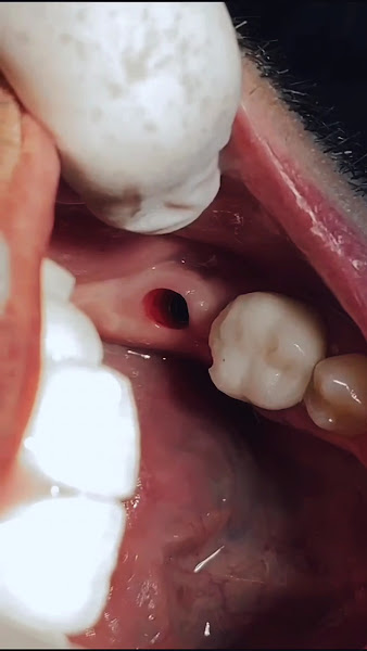 Foto 5 de Prodonto Juiz de Fora Odontologia Especializada.