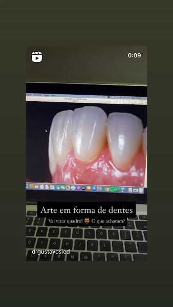 Foto 5 de Prof Dr Gustavo Siedschlag - Odontologia Premium - Lentes Dentais