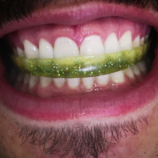 Foto 3 de Prof Dr Luciano Ambrosio Ferreira - DOR OROFACIAL - DTM - RONCO - APNEIA