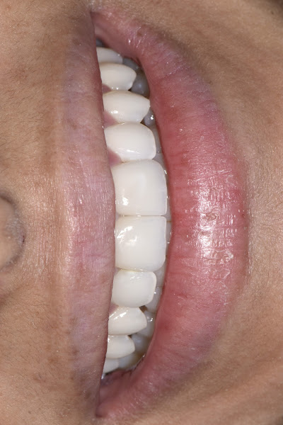 Foto 3 de Professor Paulo Staub | Staub Odontologia | Dr. Paulo Staub