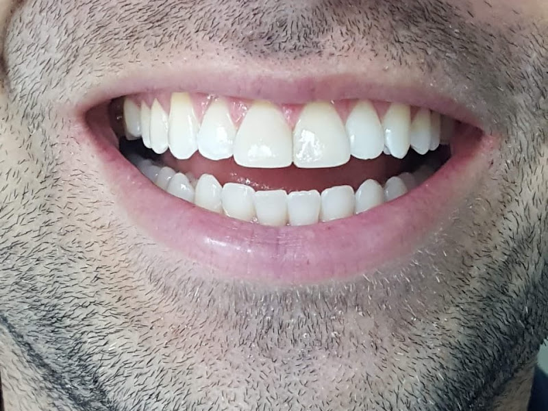 Projeto Sorriso Comunitario