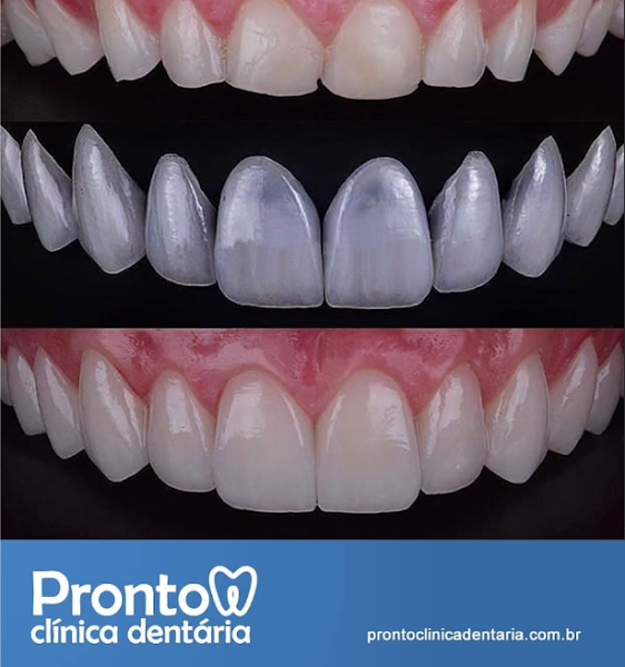Foto 3 de Pronto Clínica Dentária | Dentista Centro de Porto Alegre