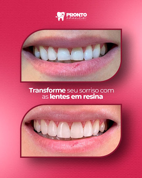 Foto 2 de Pronto Odonto Stm