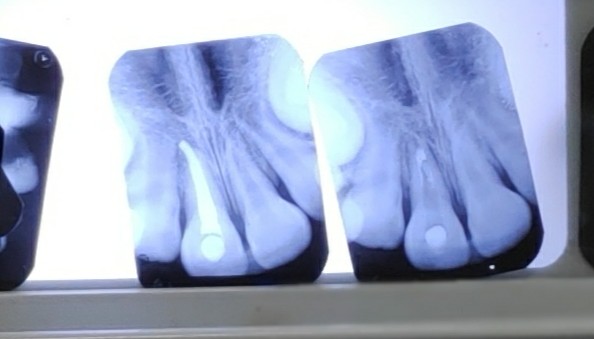 Foto 3 de Pronto Socorro Dentário Santa Maria