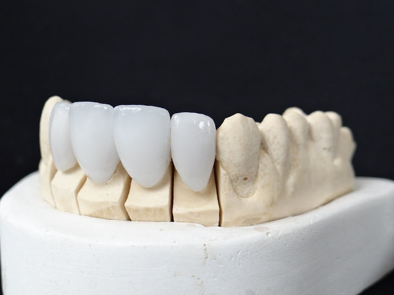 Foto 2 de Prosthetic Laboratório de Prótese Odontológica