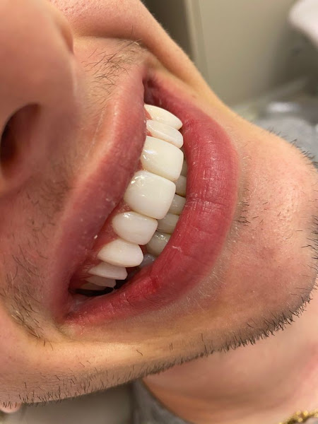 Foto 2 de Proteclin Saúde Bucal