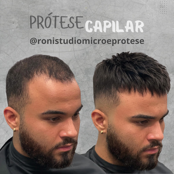 Foto 3 de Prótese Capilar Campos dos Goytacazes | Roni Stúdio