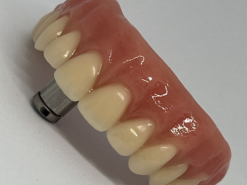 Foto 3 de Prótese Dentária