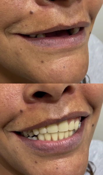 Foto 3 de Prótese dentária