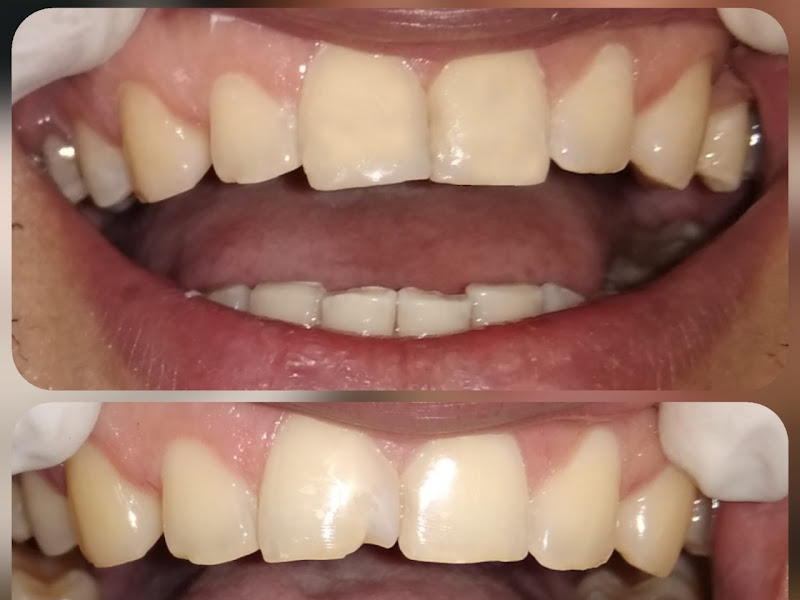 Foto 2 de Protese Dentaria