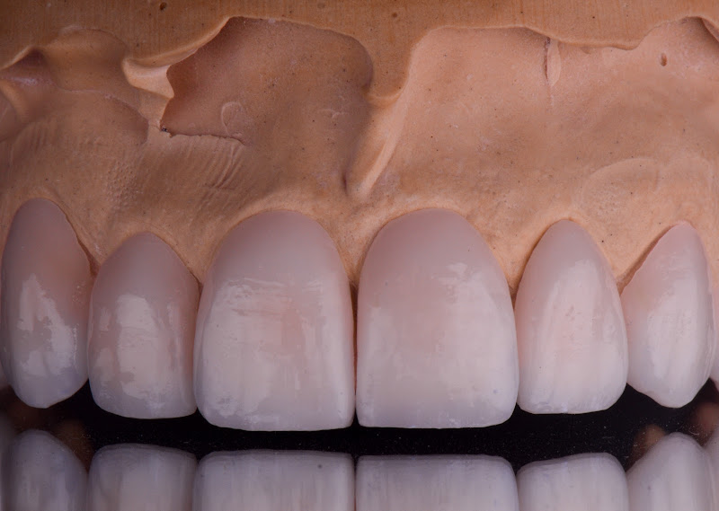 Foto 2 de Prótese Dentária Elton Helvig LTDA