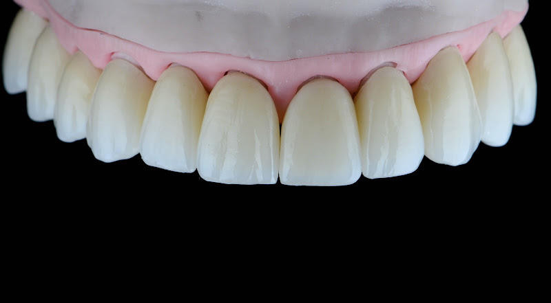 Foto 3 de Prótese Dentária Elton Helvig LTDA