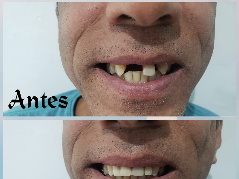 Foto 3 de Prótese Dentária Fazendo Você Sorrir