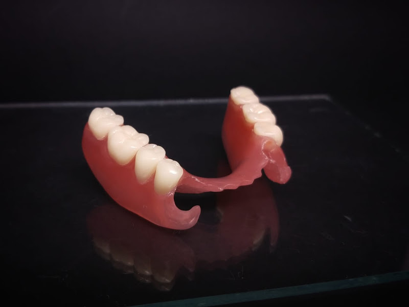 Foto 2 de Prótese Dentária Jamonot - Porto Alegre