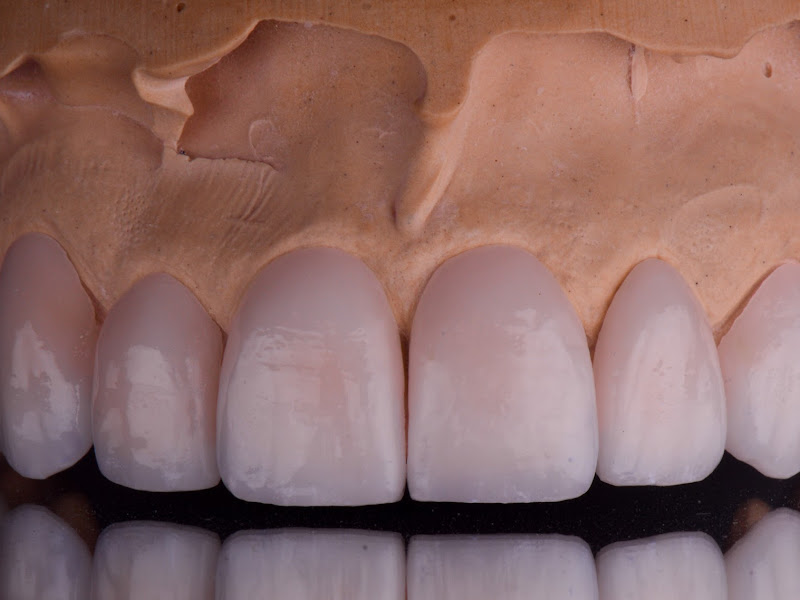 Foto 3 de Prótese Dentária Jamonot - Porto Alegre