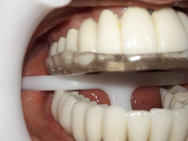 Foto 2 de Prótese Dentária Kid