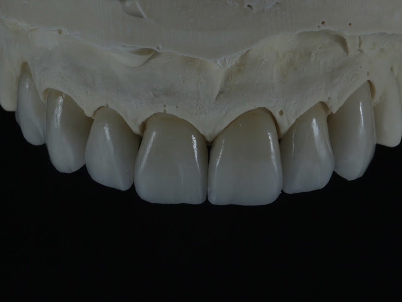 Foto 3 de Prótese Dentária Moeller