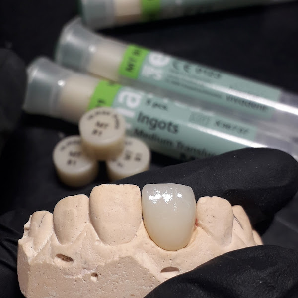 Foto 2 de Prótese dentária sousa