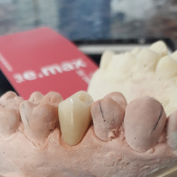 Foto 3 de Prótese dentária sousa