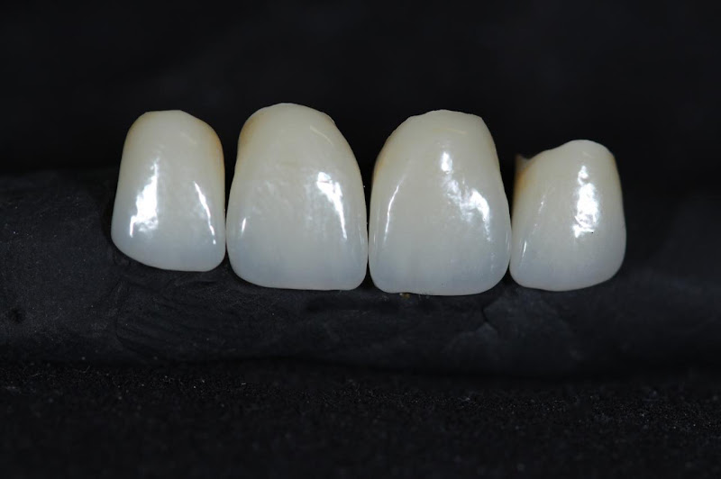Foto 2 de Prótese Dentária Venturini