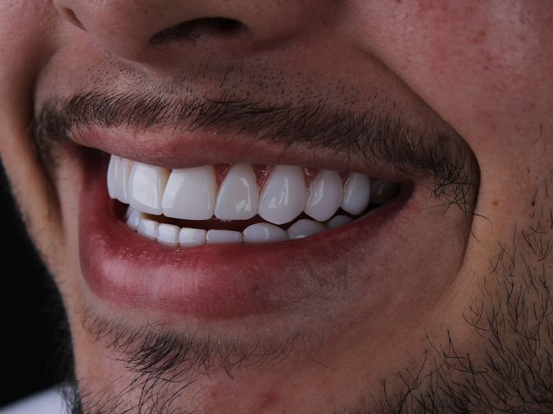 Foto 2 de Prótese na Pratica