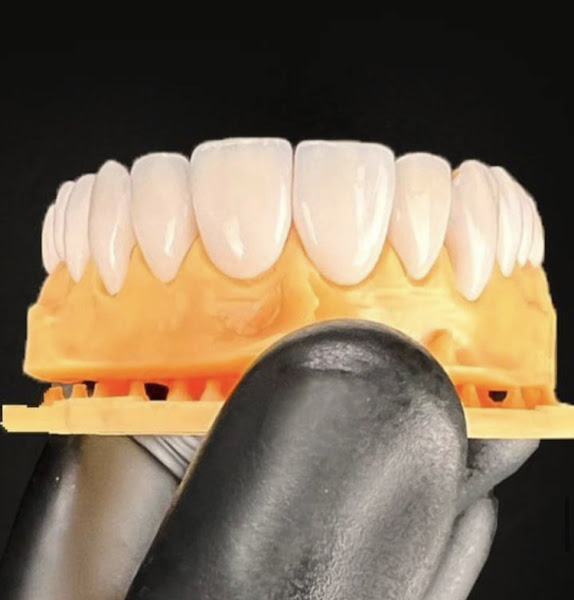 Foto 2 de Prótese Odontológica Nascimento