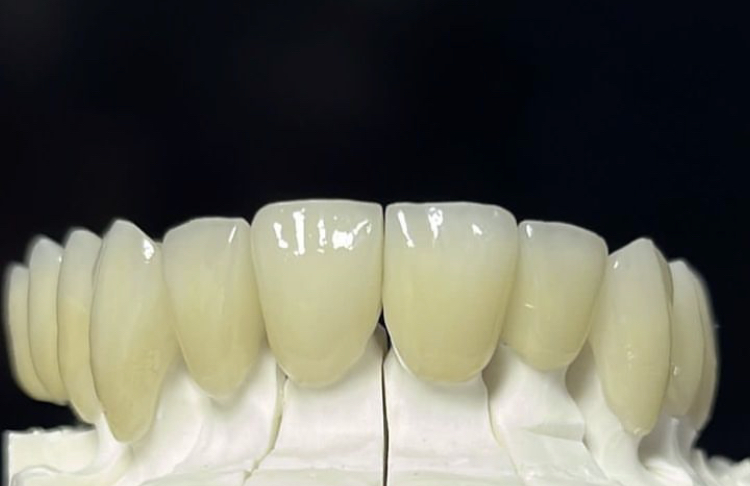 Foto 3 de Prótese Odontológica Nascimento