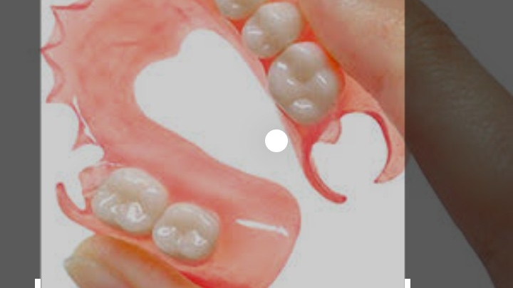 Foto 2 de Prótese Oral Macaé