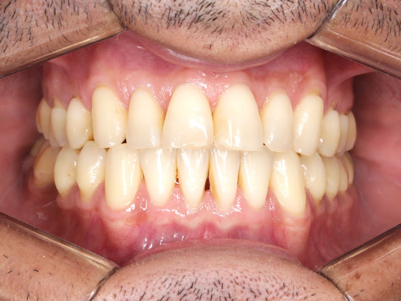 Foto 3 de Prótese Oral Macaé