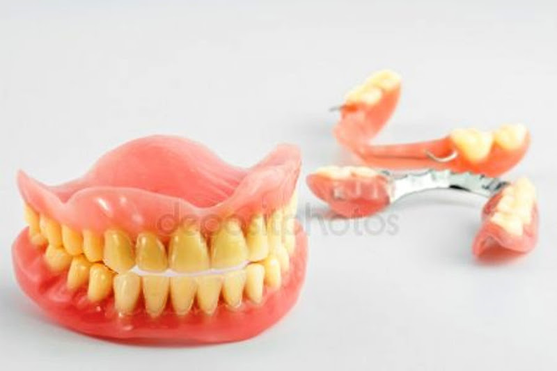 Foto 3 de Próteses Dentárias - Geralda e Alejandro