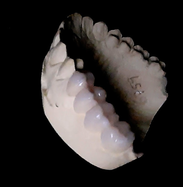 Foto 2 de Protesiart - Laboratório de Prótese Dentária